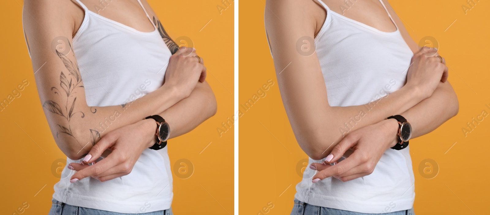 Image of Woman before and after laser tattoo removal procedure on orange background, closeup. Collage with photos, banner design