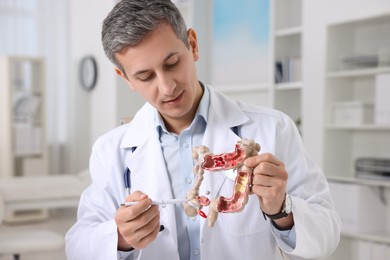 Photo of Gastroenterologist showing anatomical model of large intestine in clinic