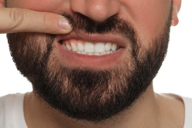 Photo of Young man showing white teeth, closeup view