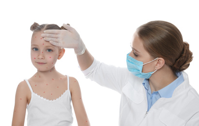 Photo of Doctor examining little girl with chickenpox on white background. Varicella zoster virus