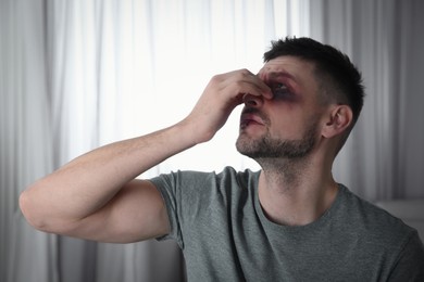 Photo of Man with bruise on face at home. Domestic violence victim