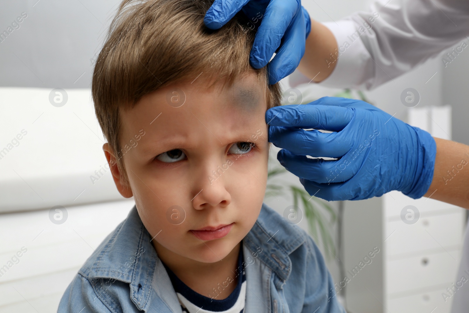 Photo of Doctor checking boy's forehead with bruise at hospital, closeup