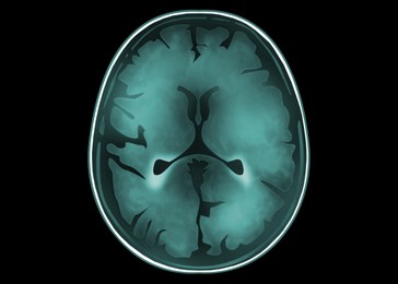 Illustration of Scan of human brain on black background, illustration