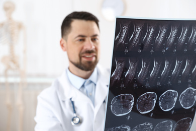 Professional orthopedist examining X-ray picture in clinic