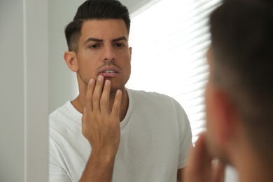 Photo of Man with herpes touching lips in front of mirror at home
