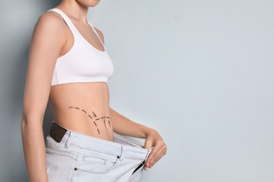 Photo of Young woman with marks on belly in big jeans after cosmetic surgery operation against color background