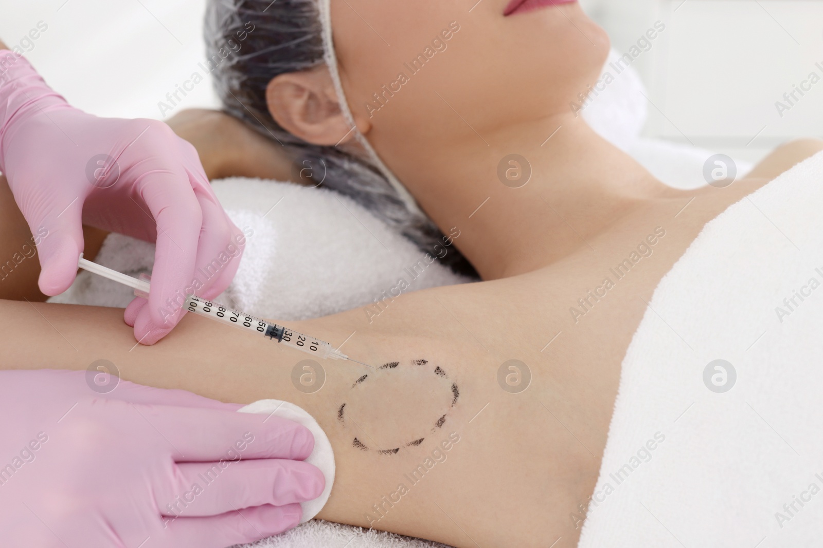 Photo of Cosmetologist injecting young woman's armpit, closeup. Treatment of hyperhidrosis