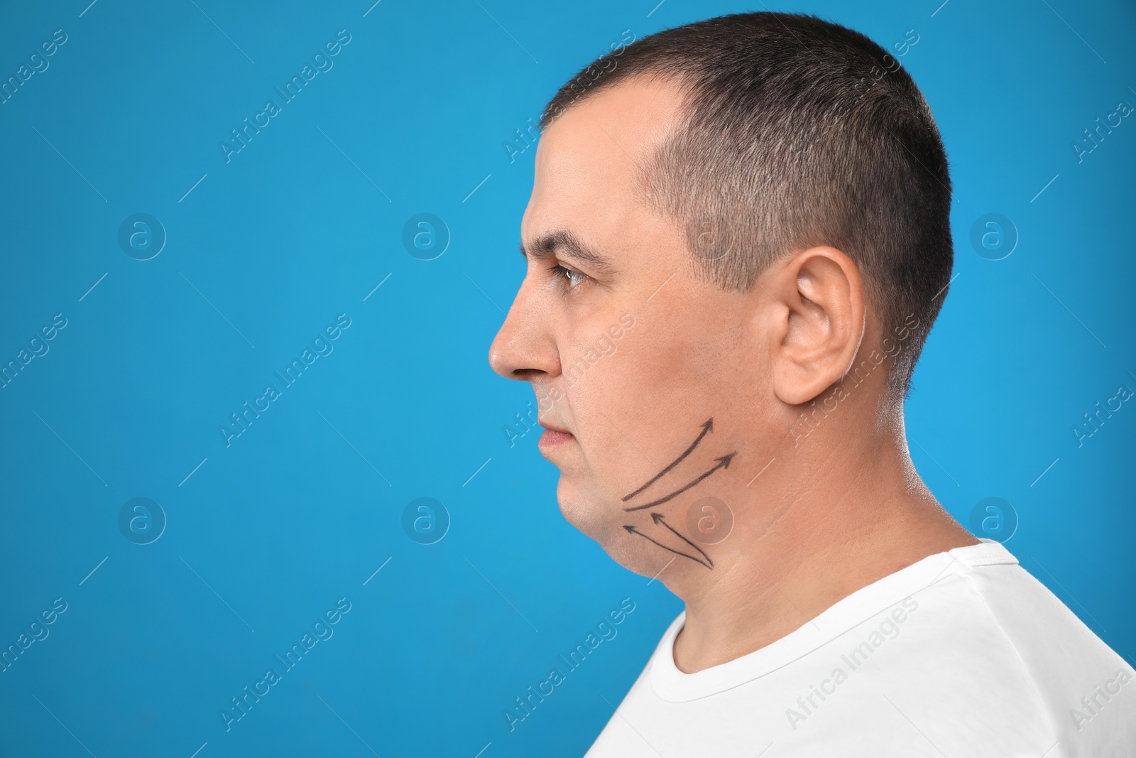 Photo of Mature man with marks on face against blue background, space for text. Double chin removal