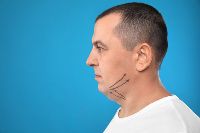 Mature man with marks on face against blue background, space for text. Double chin removal