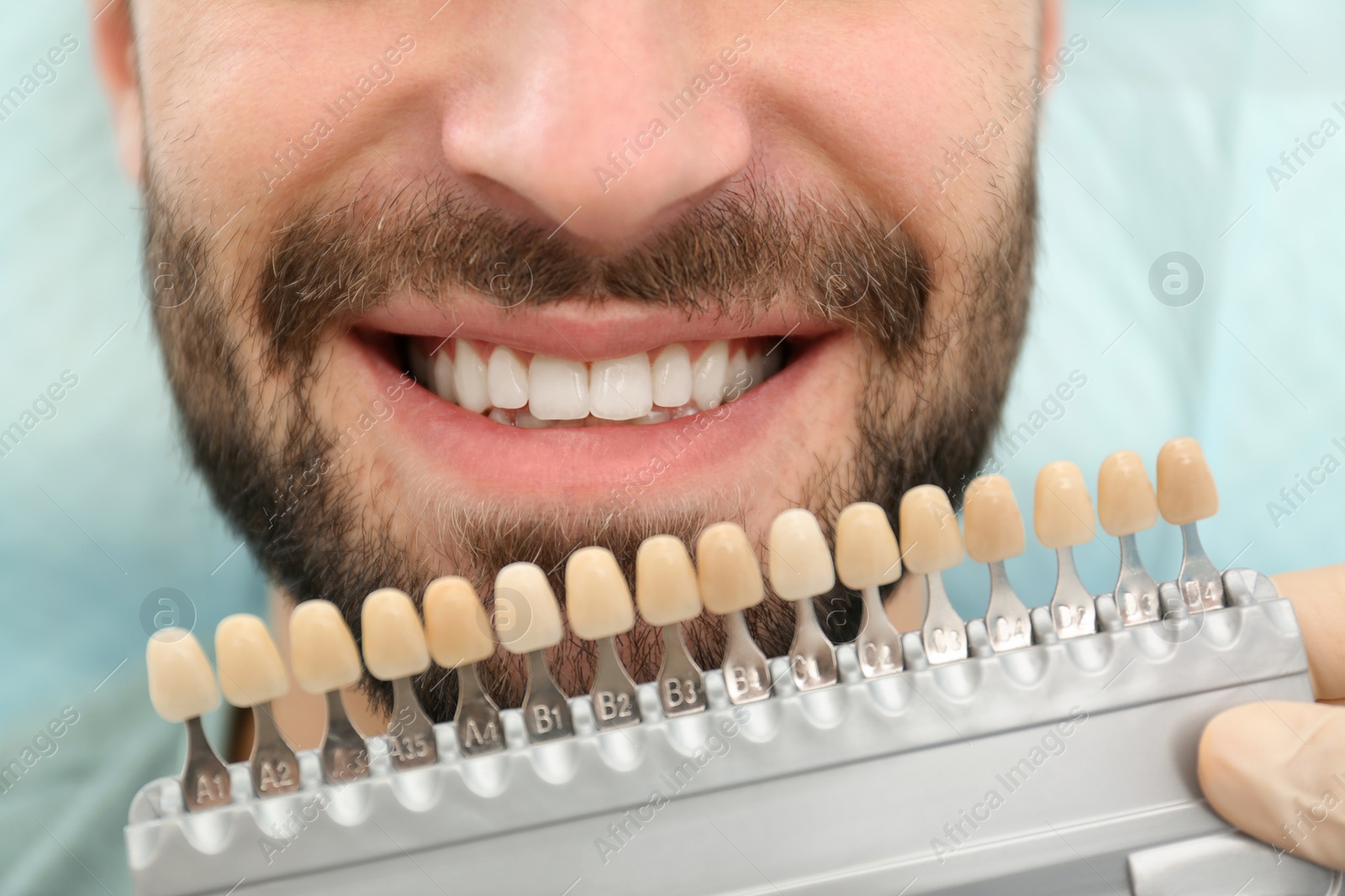 Photo of Dentist matching young man's teeth color with palette, closeup