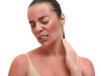 Woman with sunburned skin on white background