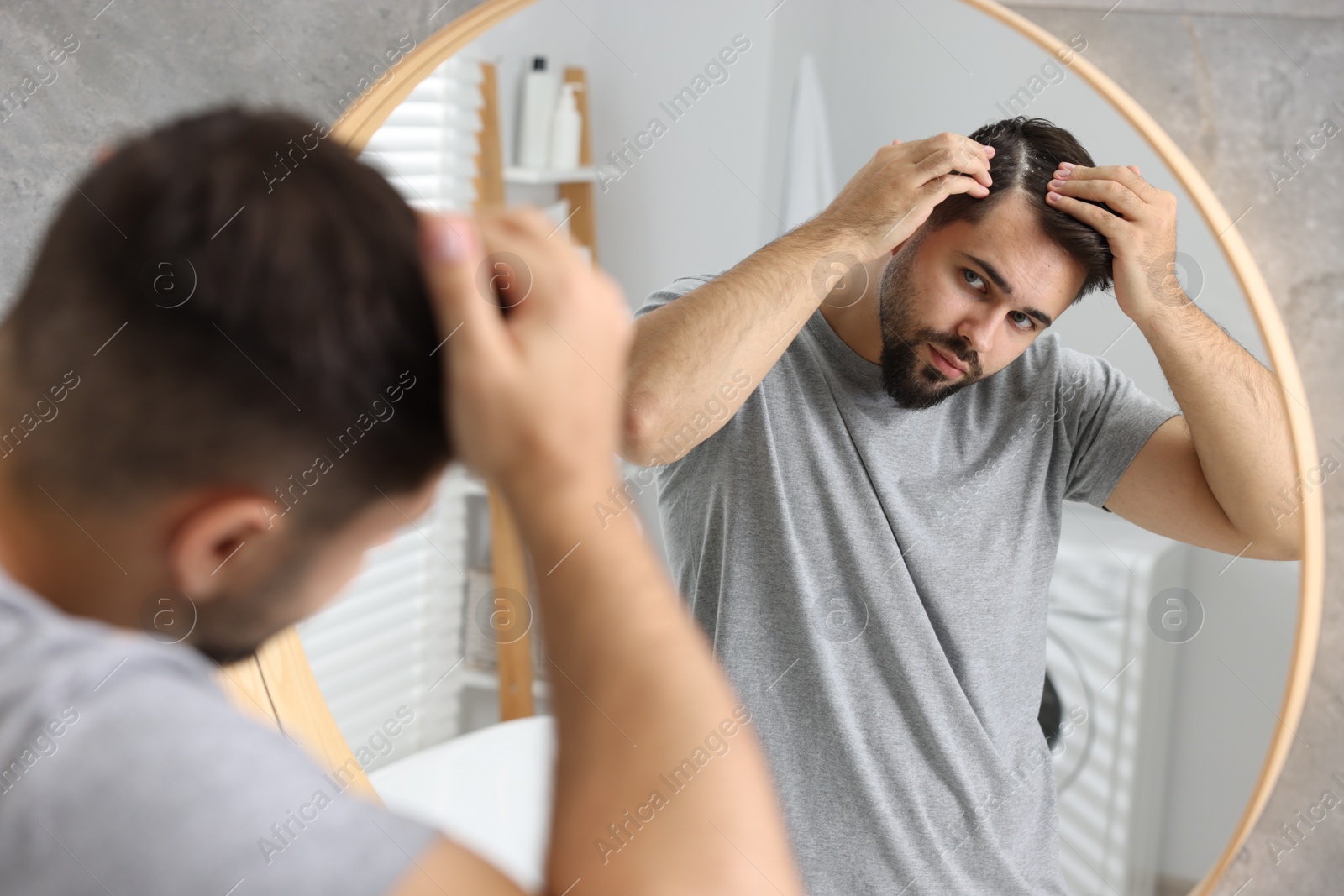 Photo of Man with dandruff in his dark hair near mirror in bathroom