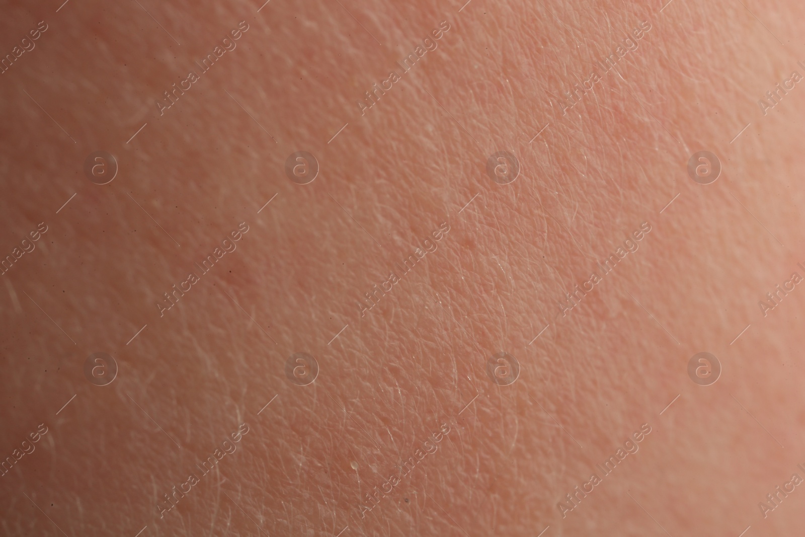 Photo of Texture of dry skin as background, macro view