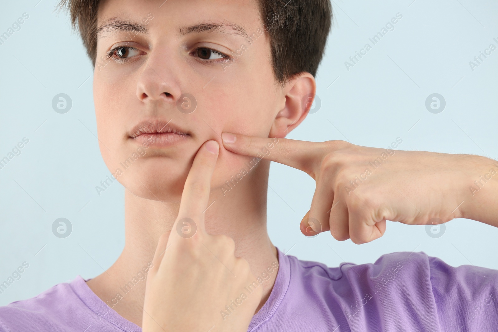 Photo of Teenage boy with acne problem on light background