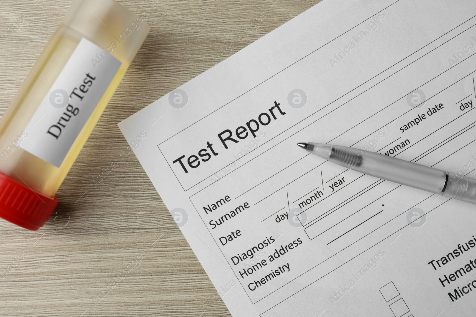 Photo of Drug test result form, container with urine sample and pen on wooden table, flat lay