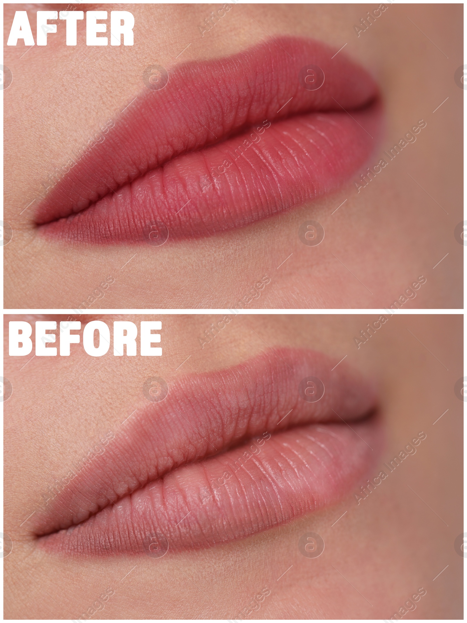 Image of Collage with photos of young woman before and after permanent lip makeup, closeup