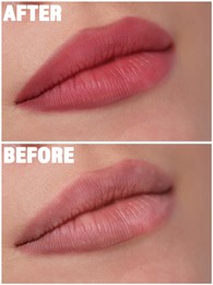 Collage with photos of young woman before and after permanent lip makeup, closeup