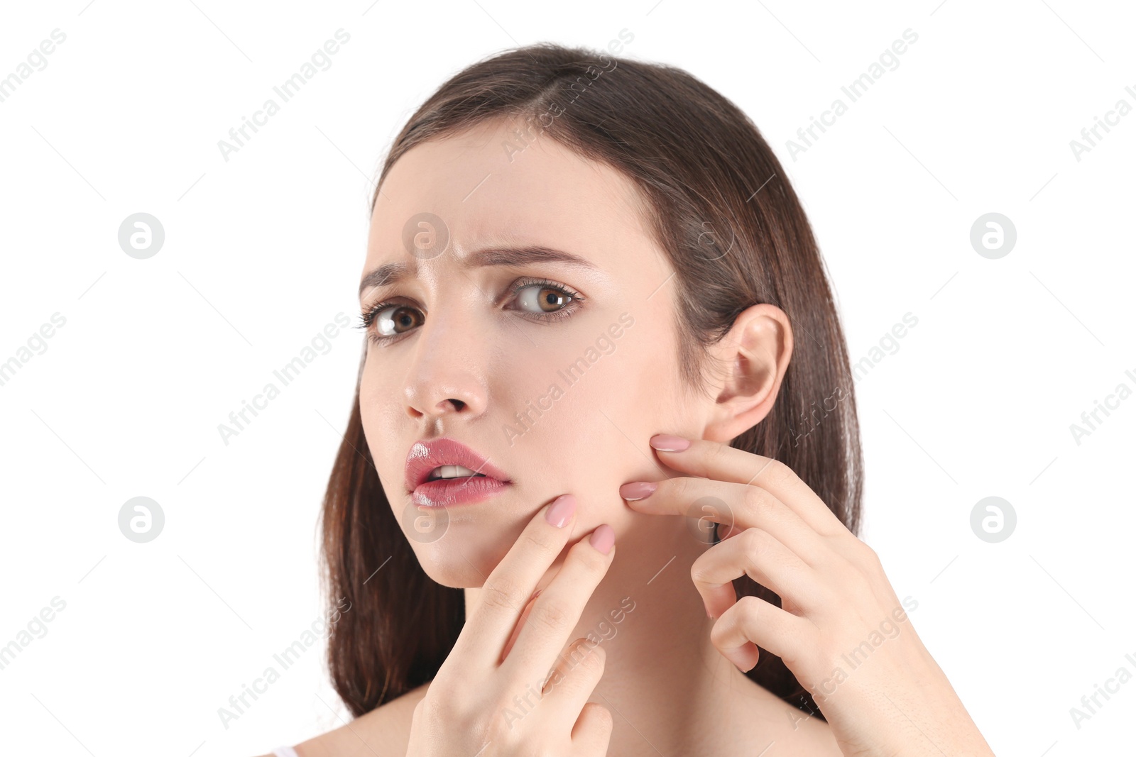 Photo of Teenage girl with acne problem against white background