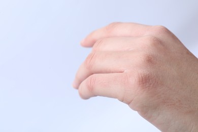 Photo of Woman with dry skin on hand against light background, closeup. Space for text