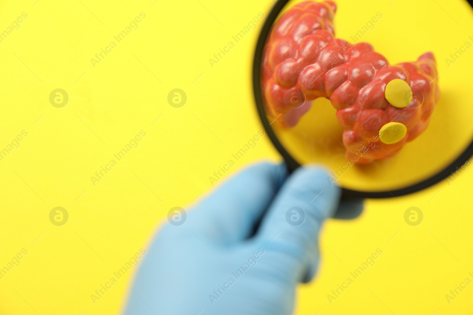 Photo of Endocrinologist looking at model of thyroid gland through magnifying glass on yellow background, closeup. Space for text