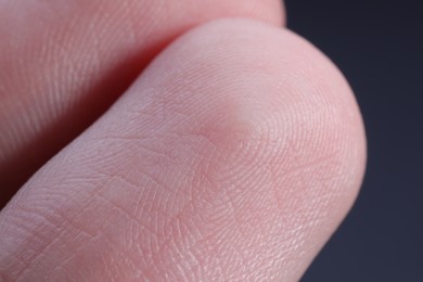 Photo of Macro view of finger with friction ridges