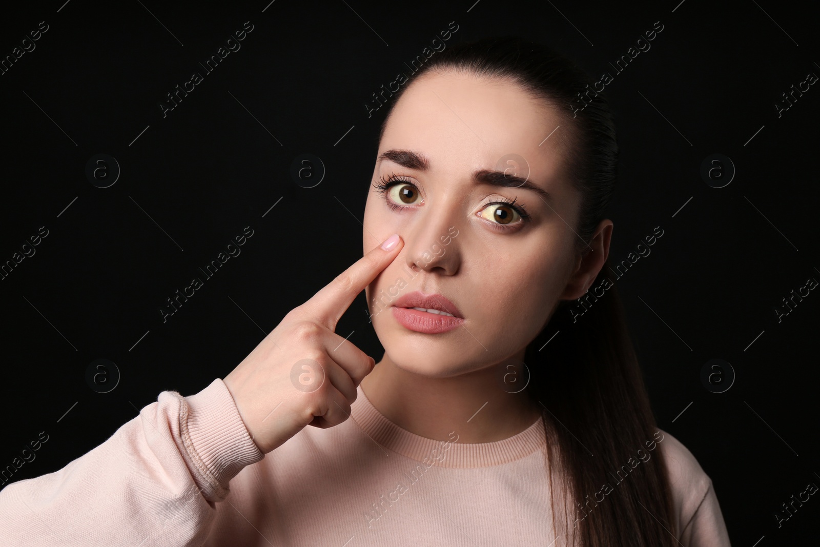 Photo of Woman checking her health condition on black background. Yellow eyes as symptom of problems with liver