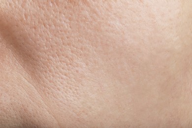 Photo of Closeup view of human skin as background