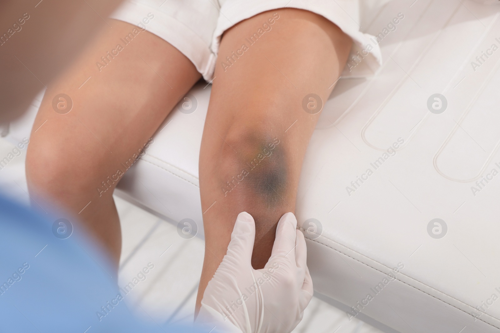 Photo of Doctor examining little child's bruised knee in hospital, closeup