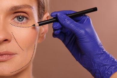 Woman preparing for cosmetic surgery, light brown background. Doctor drawing markings on her face, closeup