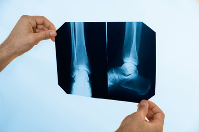 Photo of Orthopedist examining X-ray picture on viewing screen, closeup