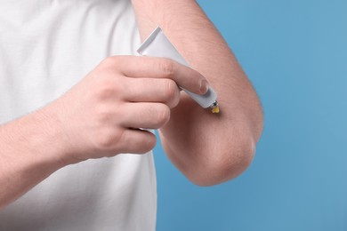 Photo of Man applying ointment from tube onto his elbow on light blue background, closeup