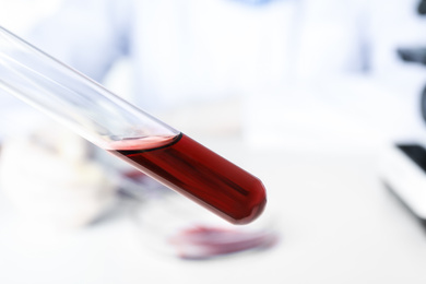 Photo of Test tube with blood sample on blurred background, closeup. Virus research