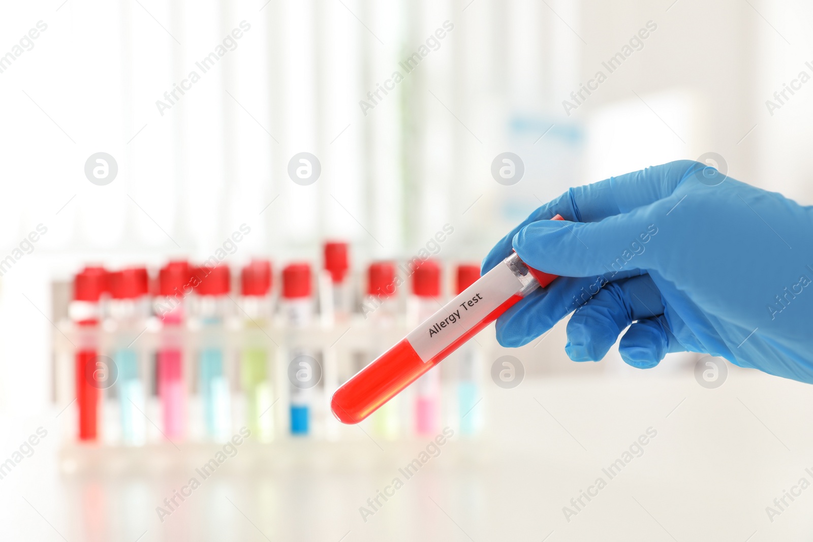 Photo of Doctor holding tube with label ALLERGY TEST over table, closeup