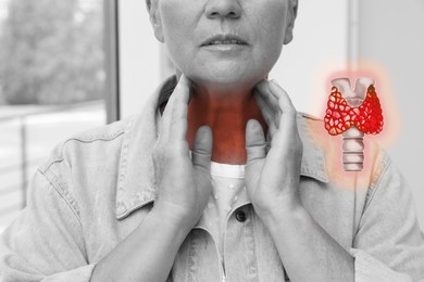 Image of Mature woman with thyroid gland disease indoors