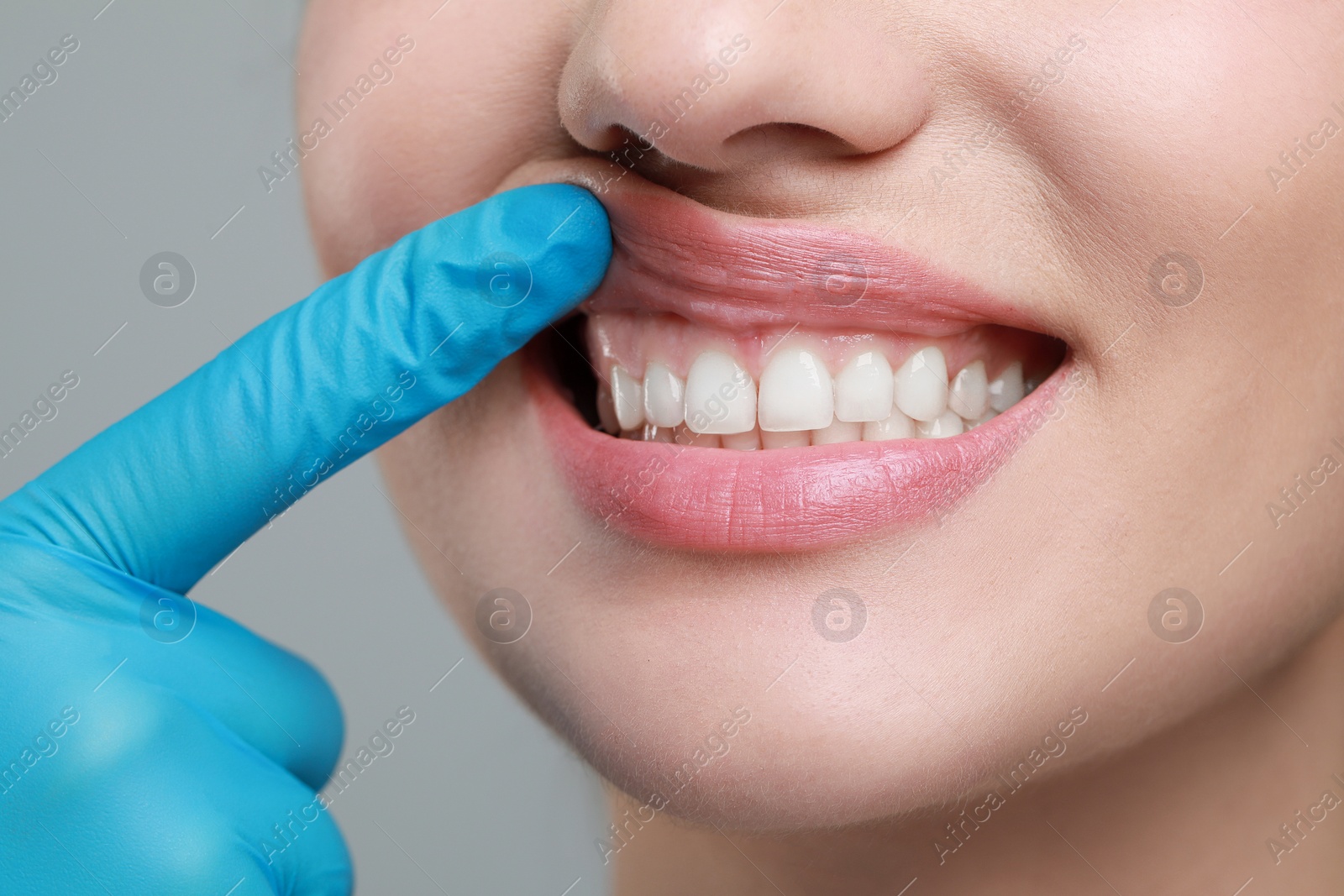 Photo of Doctor examining woman's gums on grey background, closeup