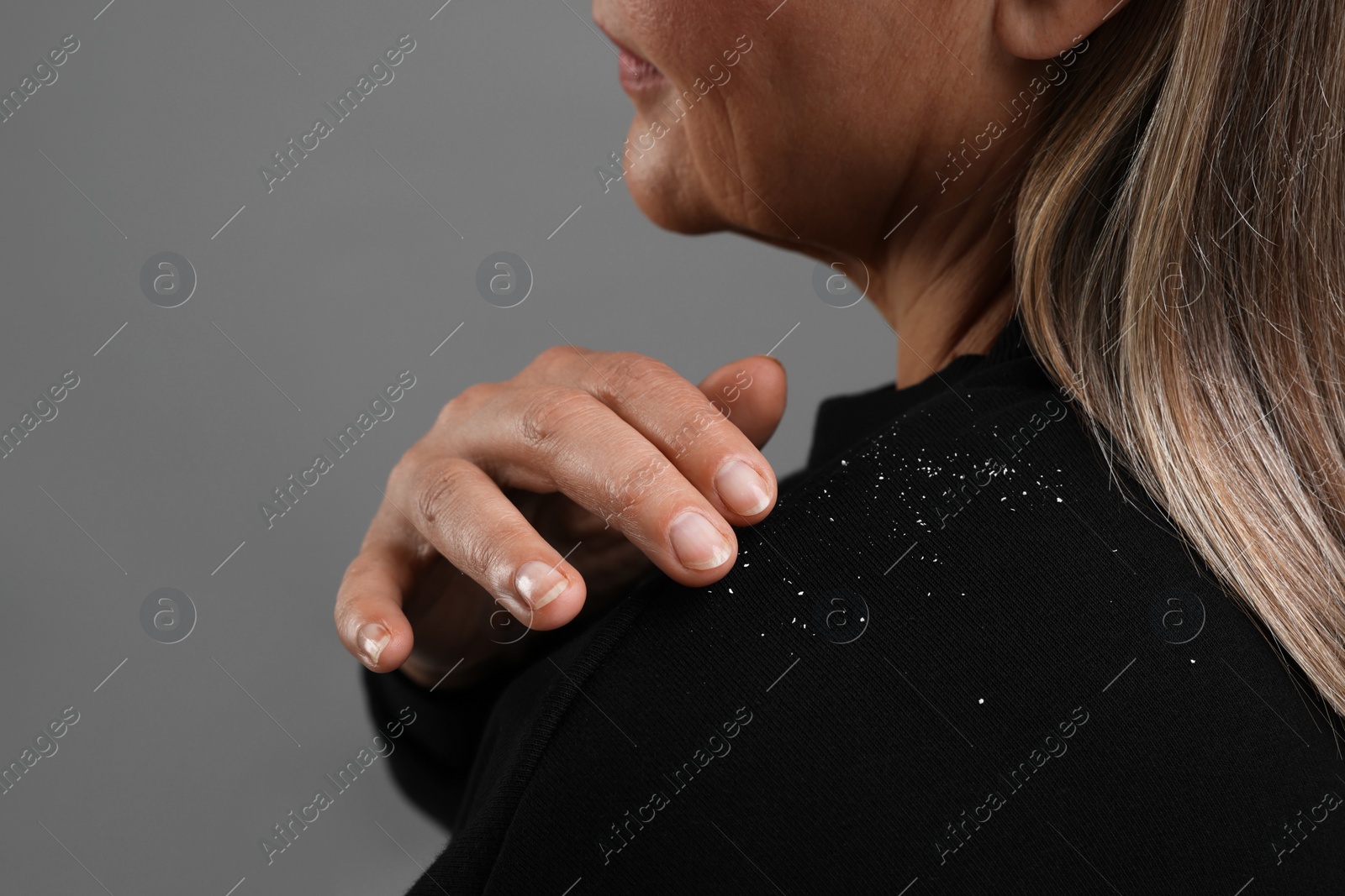 Photo of Woman brushing dandruff off her sweater on gray background, closeup. Space for text