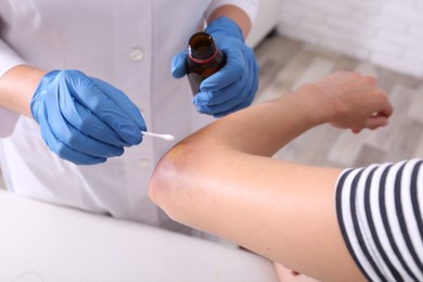 Photo of Doctor applying medication on woman's elbow with bruise in hospital, closeup
