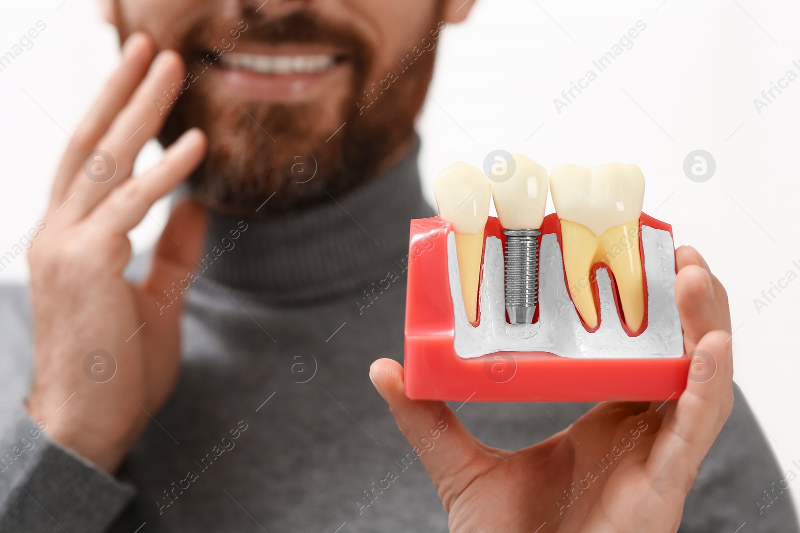 Photo of Man holding educational model of dental implant on blurred background, closeup