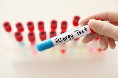 Photo of Doctor holding tube with label ALLERGY TEST over table, closeup