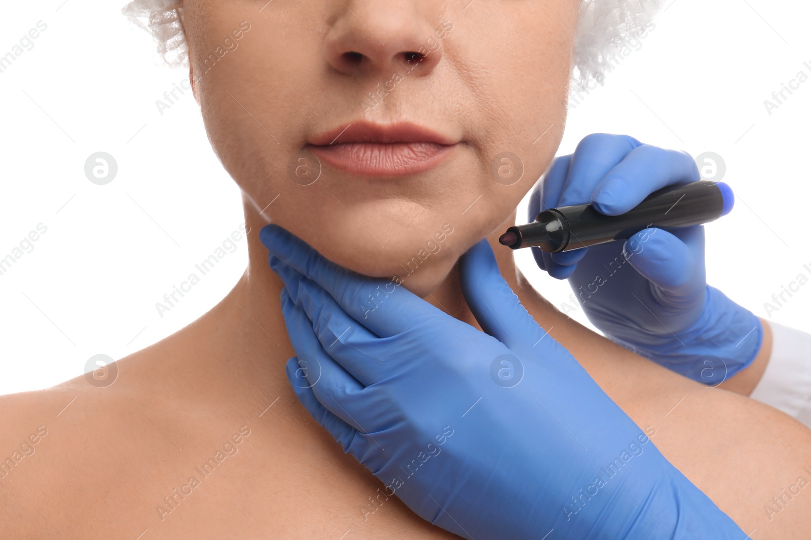 Photo of Surgeon with marker preparing woman for operation against white background, closeup. Double chin removal