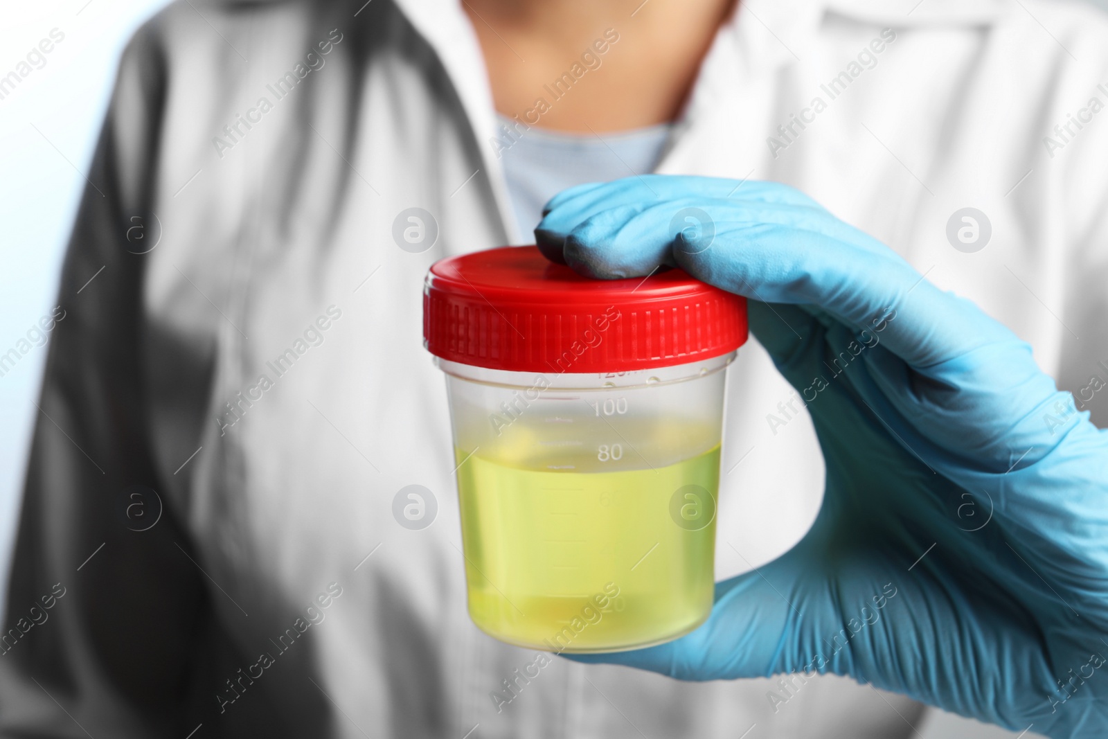 Photo of Doctor holding container with urine sample for analysis, closeup