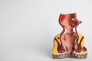 Anatomical model of rectum with hemorrhoids on light background. Space for text