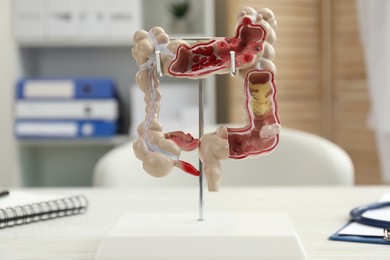 Photo of Model of large intestine on white table in clinic, closeup