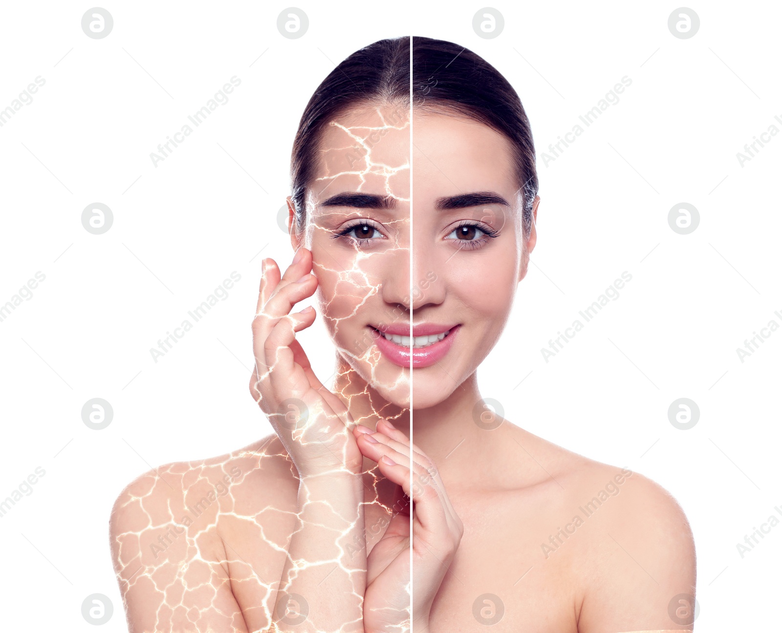 Image of Collage with photos of woman having dry skin problem before and after dry skin problem on white background