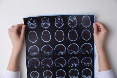 Doctor examining MRI images of patient with multiple sclerosis at white table, top view