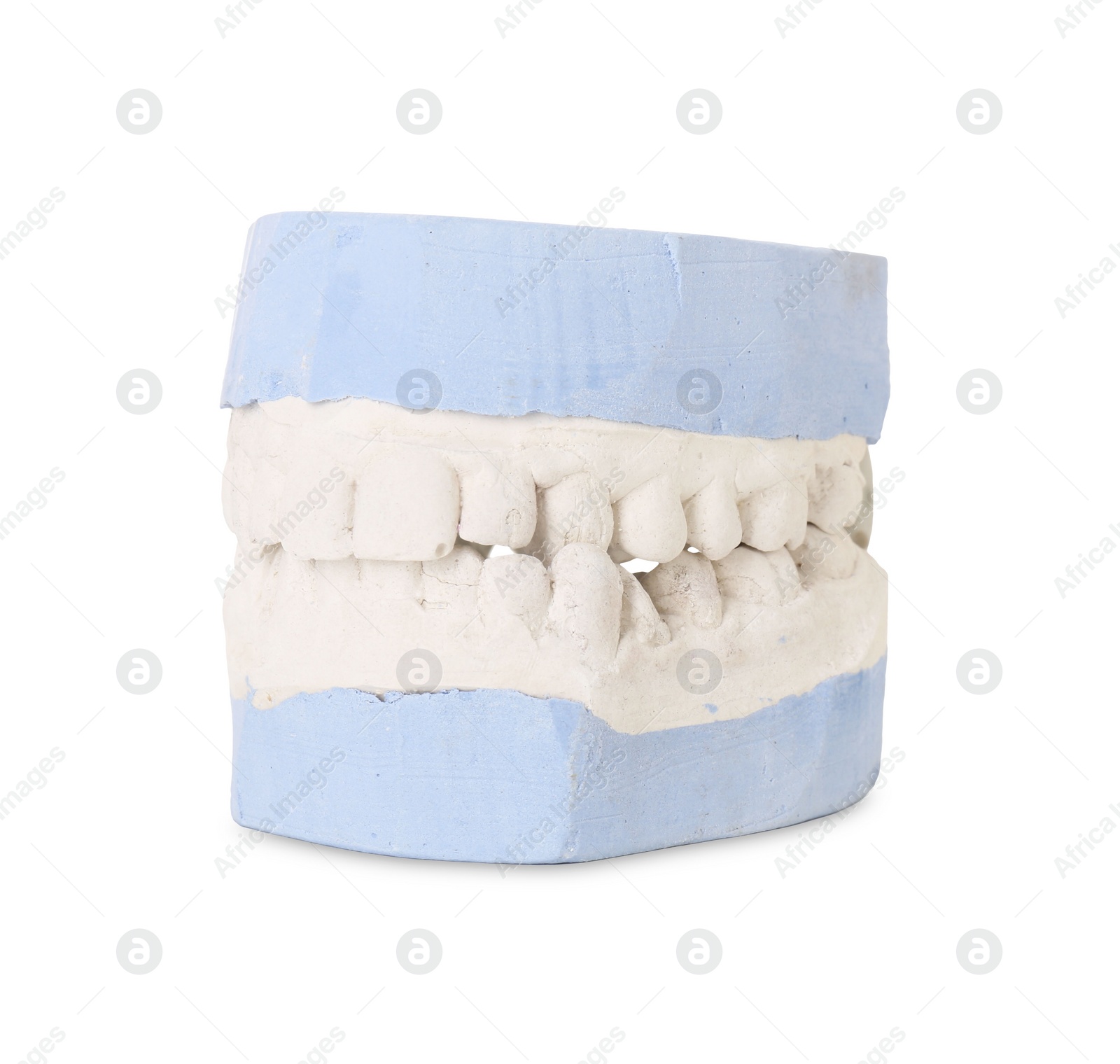 Photo of Dental model with gums isolated on white. Cast of teeth