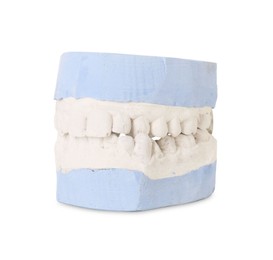 Photo of Dental model with gums isolated on white. Cast of teeth