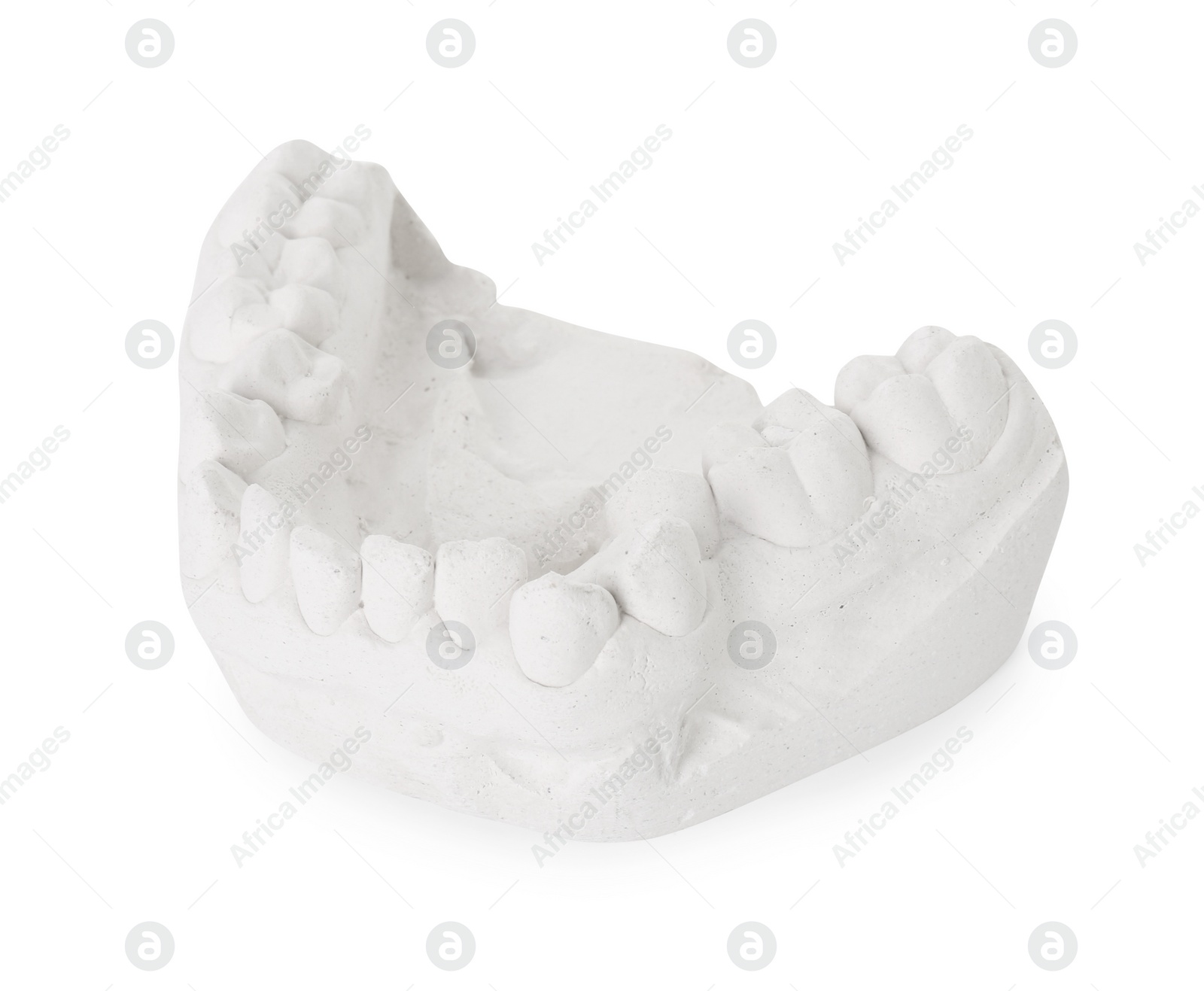 Photo of Dental model with gum isolated on white. Cast of teeth