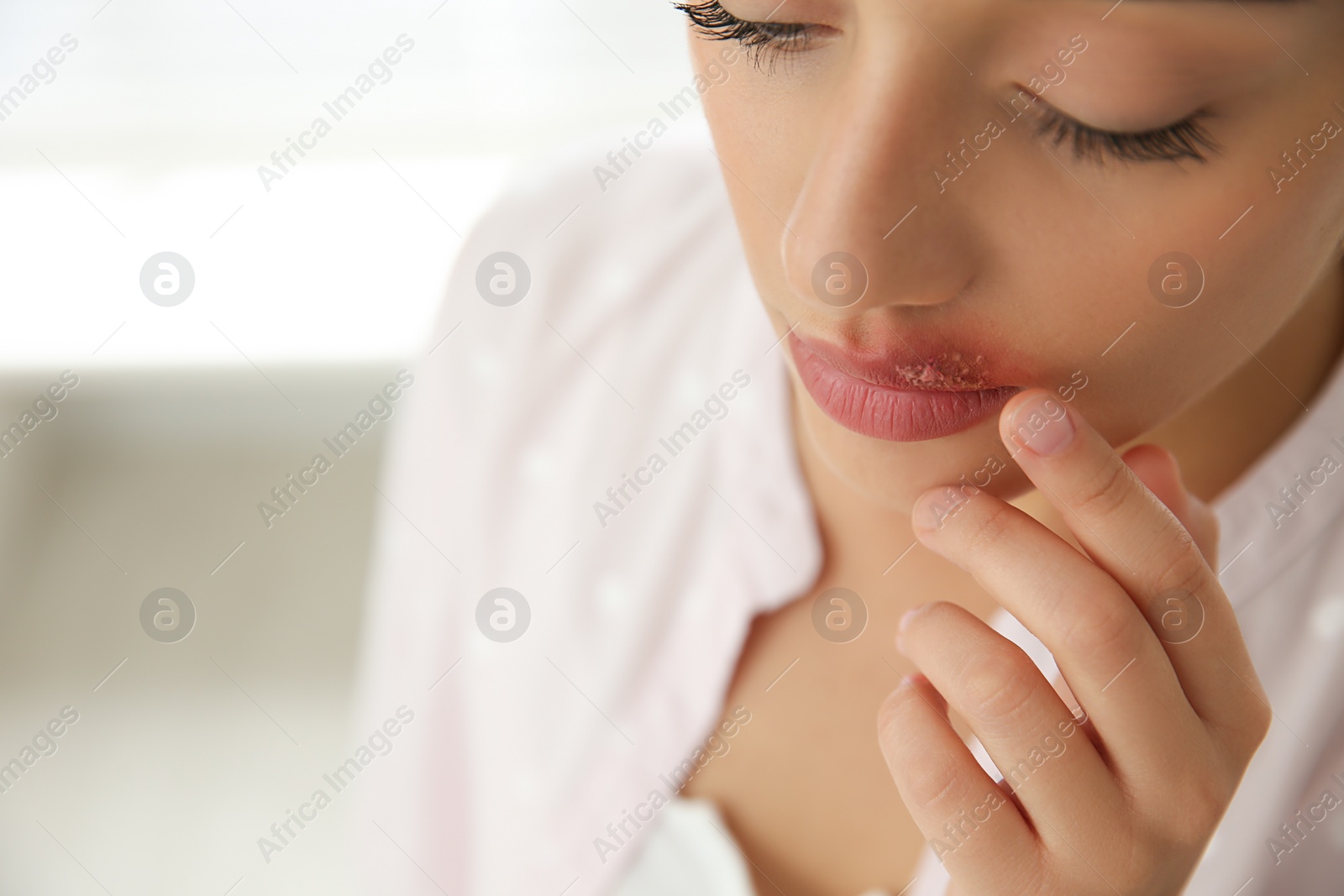 Photo of Woman with herpes touching lips against blurred background, closeup