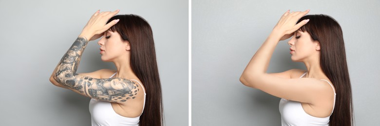 Image of Woman before and after laser tattoo removal procedure on light grey background. Collage with photos, banner design